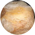 Ambergris